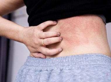 Elle pensait faire une simple allergie, les médecins diagnostiquent le pire