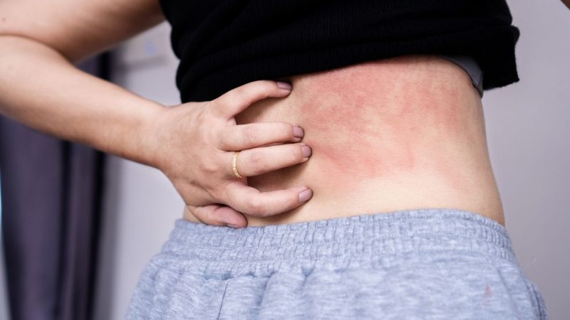 Elle pensait faire une simple allergie, les médecins diagnostiquent le pire
