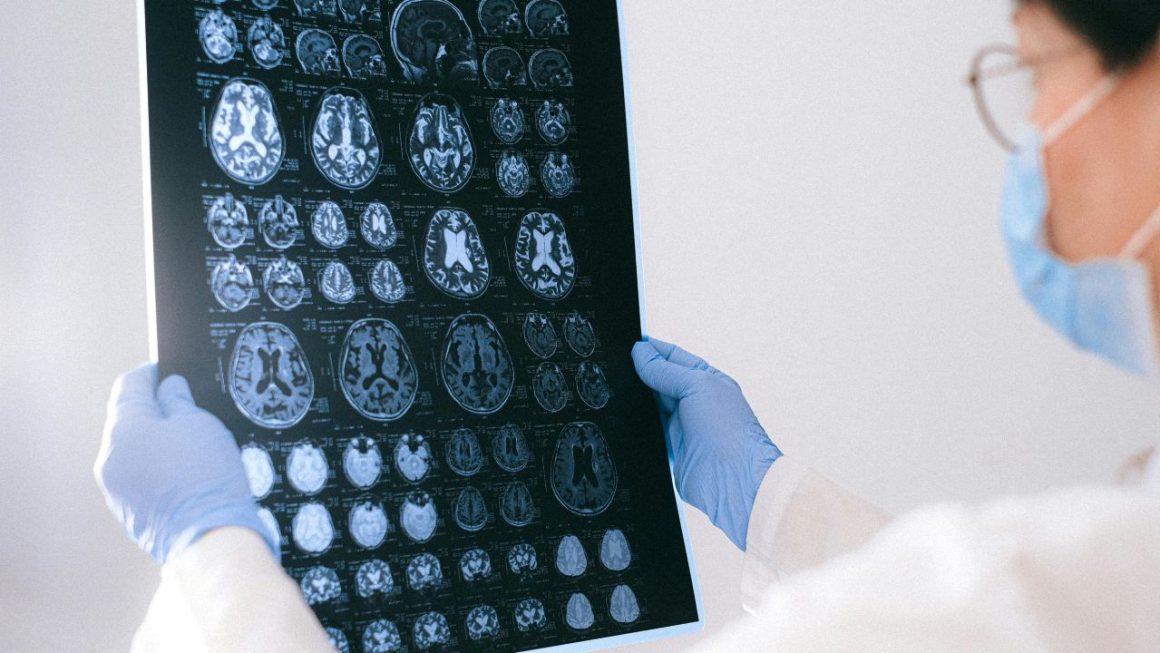 Alzheimer médicaments augmentent risque