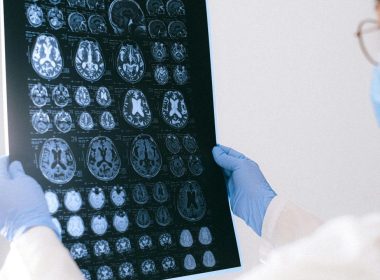 Alzheimer médicaments augmentent risque