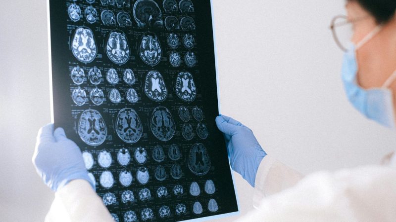 Alzheimer médicaments augmentent risque
